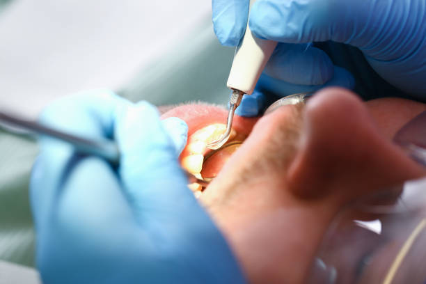 Best Weekend Emergency Dentist in Lake Darby, OH