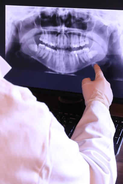 Best Emergency Tooth Extraction in Lake Darby, OH